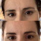 Patchs nocturnes liftants en silicone   réutilisables & 100% naturels